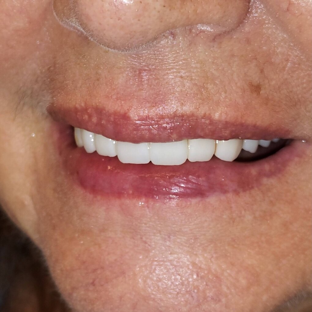dentista roma prati riabilitazioni complesse